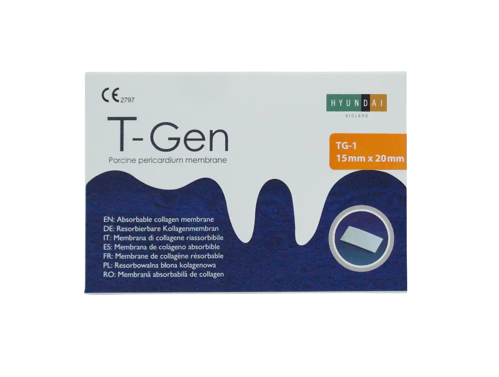 SAM_4798--T-Gen-TG-1-box #2