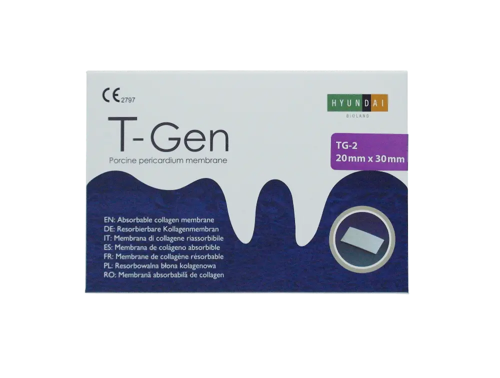 SAM_4799--T-Gen-TG-2-box #2