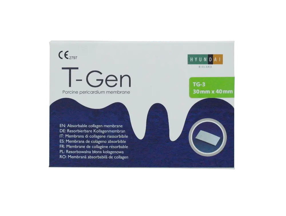 SAM_4801--T-Gen-TG-3-box #2